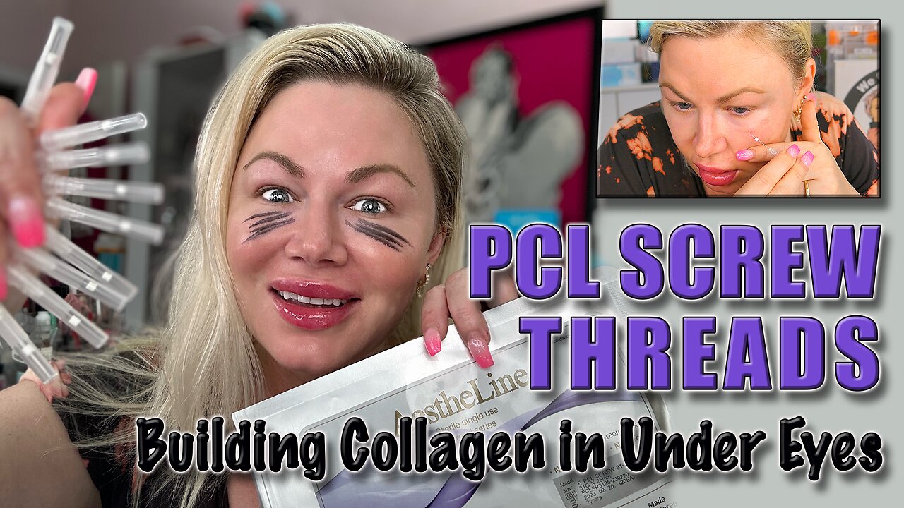 Building Collagen Under Eyes with PCL Screw threads! AceCosm.com, code Jessica10 saves you Money