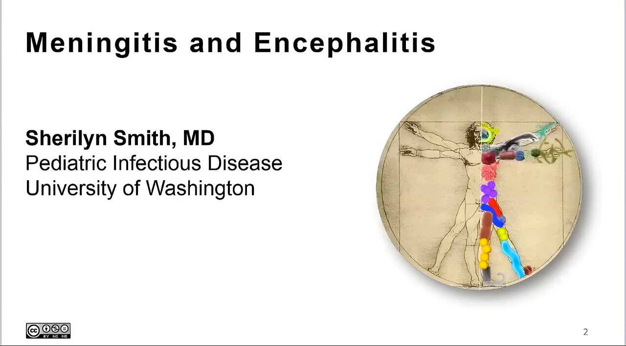 1. Overview of Meningitis and Encephalitis - Sherilyn Smith, MD (Paediatric Infectious Disease Doctor)