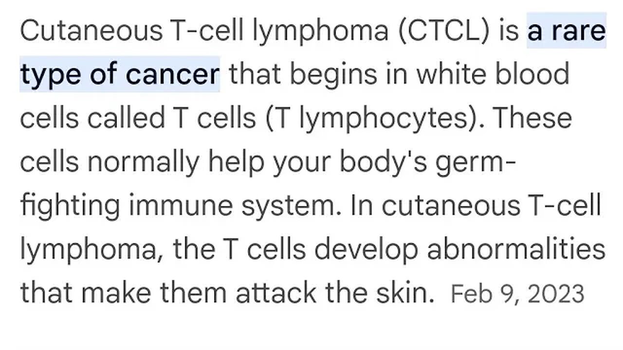 Cutaneous T-cell lymphoma (CTCL) is a rare type of cancer