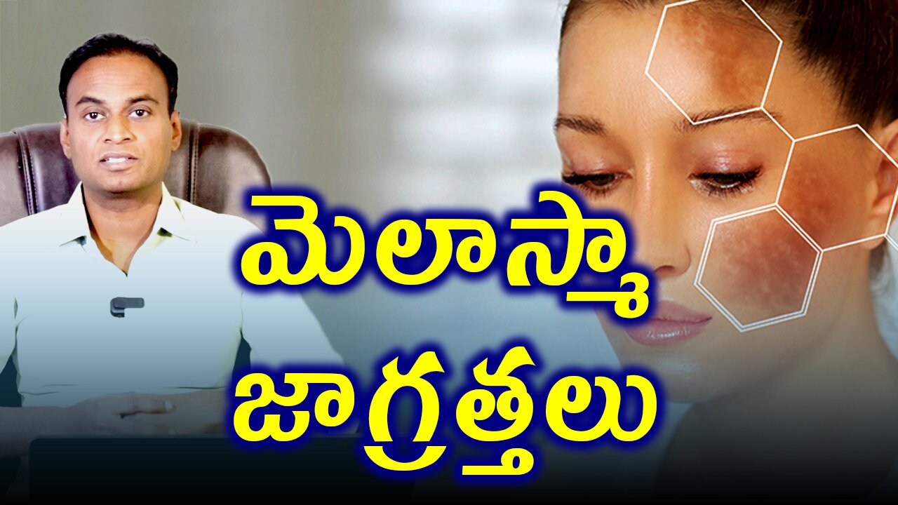 మెలాస్మా లేదా మంగుమచ్చలు కోసం జాగ్రత్తలు Precautions For Melasma | Melasma Remedy Treatment & Cure