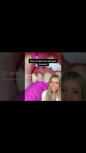 Dental And Teeth Hygiene