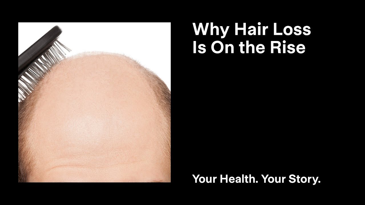 Why Hair Loss Is On the Rise