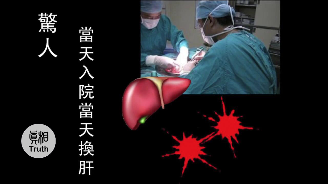 驚人！當天入院當天換肝！ | 真相傳媒