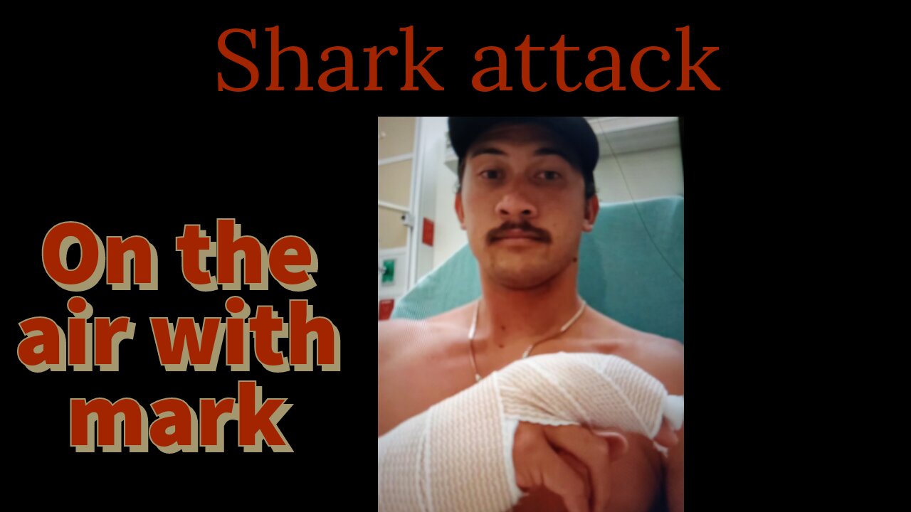 Florida man almost gets hand taken off by shark