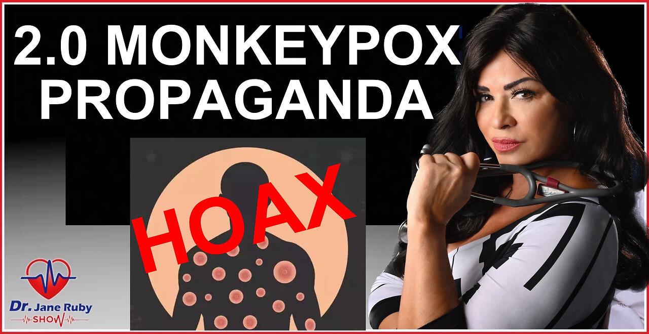 INCOMING WHO/UN MONKEYPOX (2ND) HOAX