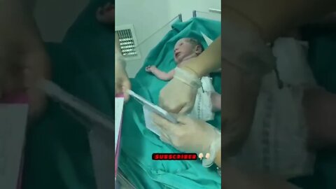 newborn baby #shorts #shortsvideo #voiceofkanij #doctordream