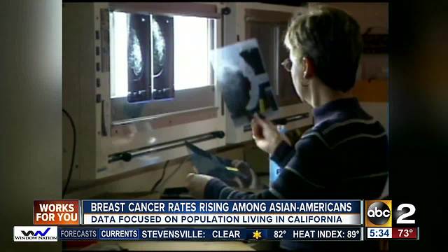 New study finds breast cancer rates increasing among Asian-Americans