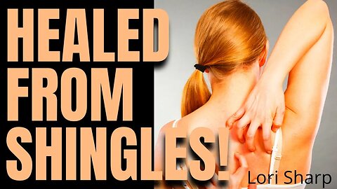 HEALED FROM SHINGLES! Lori Sharp #testimony