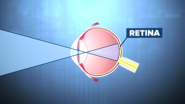 How blue lights affect your eye