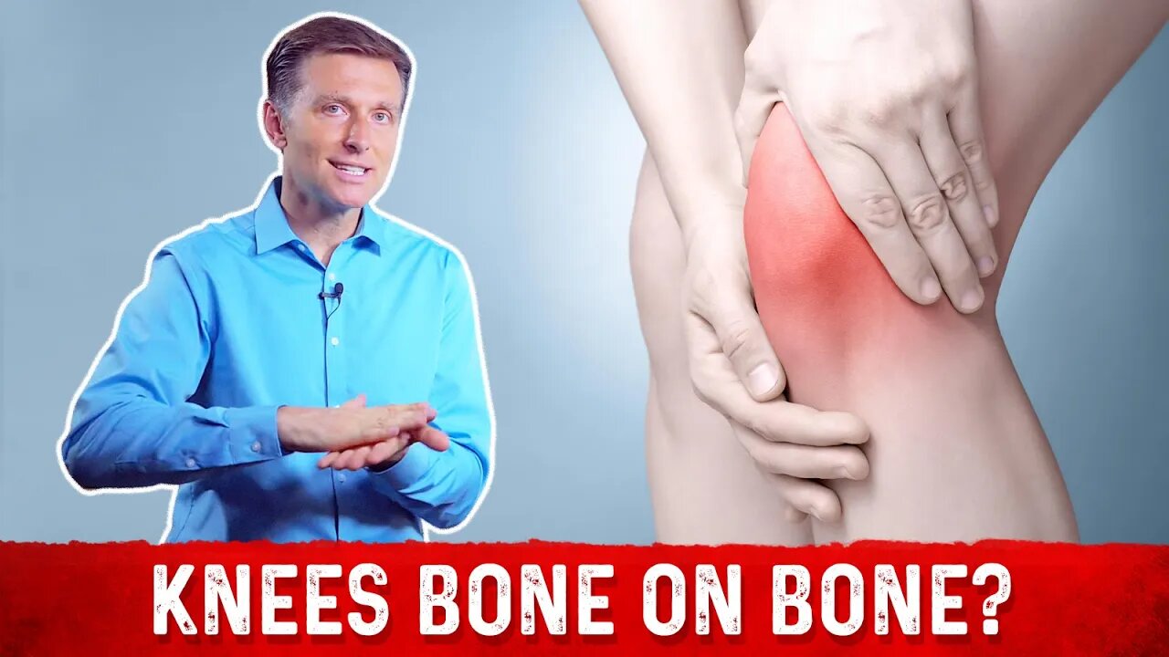 Knee Osteoarthritis: Bone On Bone Knee Pain Relief Treatment By Dr.Berg