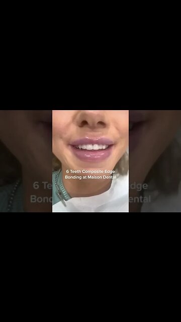 Dental And Teeth Hygiene