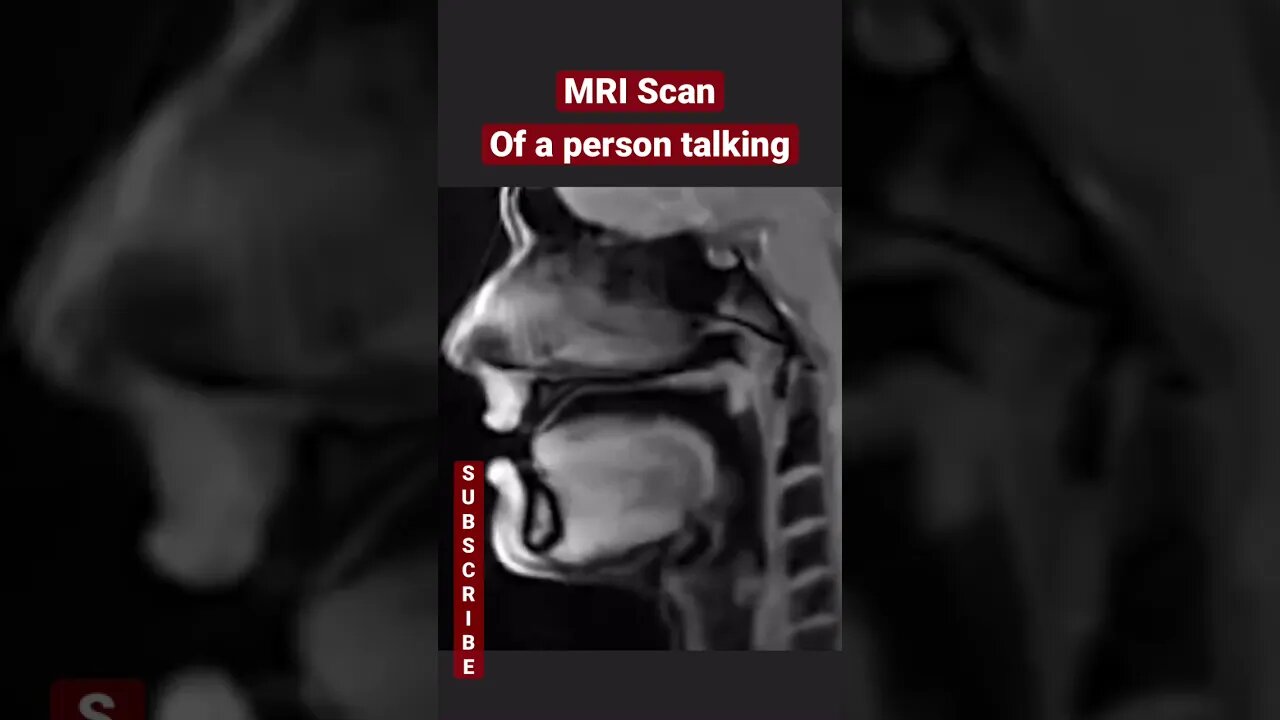 MRI Scan of a Person Talking