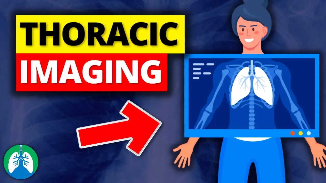 Thoracic Imaging (Overview) | Chest X-Ray | CT Scan | V/Q Scan | PET Scan