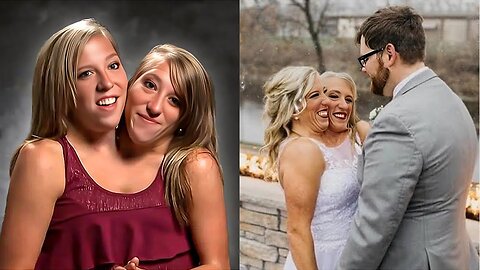 Conjoined Twins Marry 1 Man (We have questions)