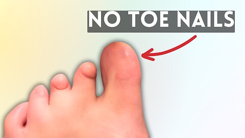 I was born without toe nails - Doctor was stunned