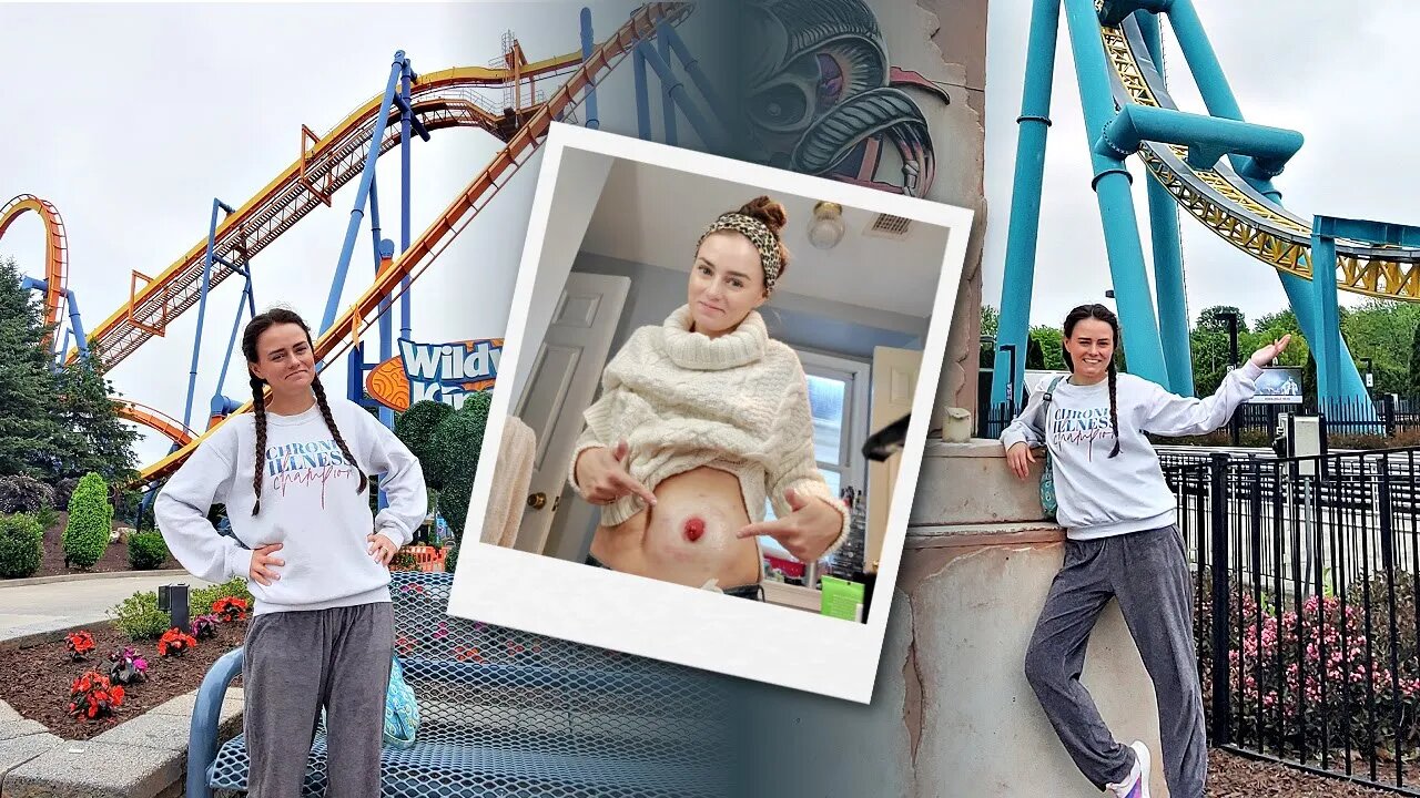 Can You Ride Roller Coasters with a Stoma? (A Trip to Dorney Park) | Let's Talk IBD