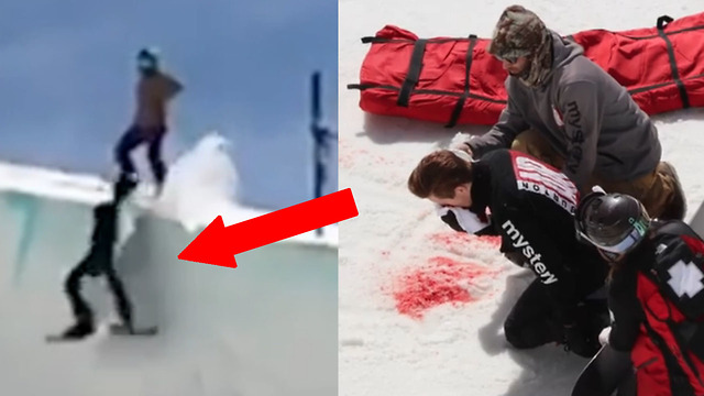 Shaun White Suffers BLOODY Face Injury in Nasty Halfpipe Crash During Olympic Training