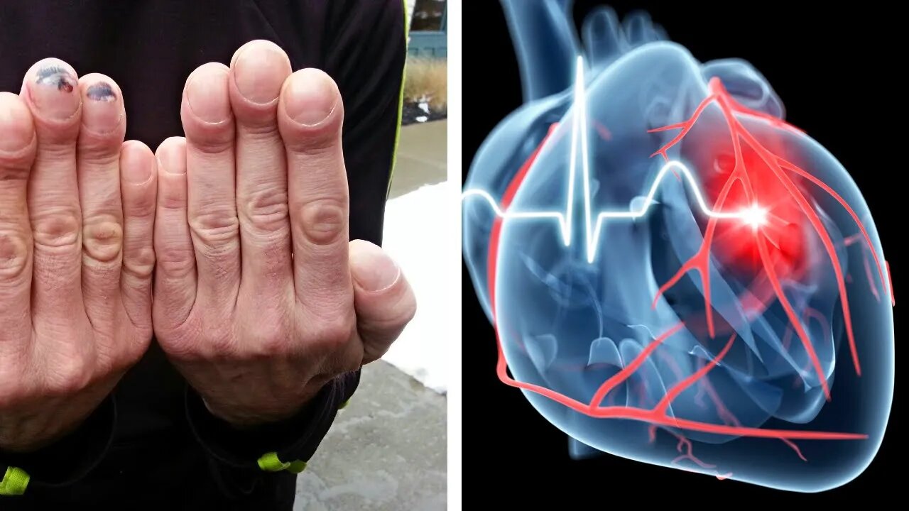 7 Health Issues Revealed by Your Hands - #1 Could Save Your Life!