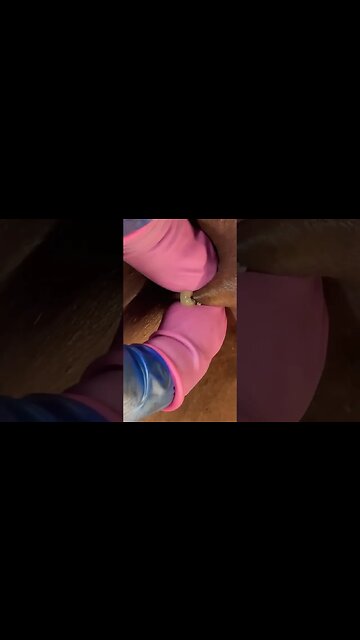 Infected cyst #pimple #extraction #popping #skincare #cyst #whiteheads #blackheads