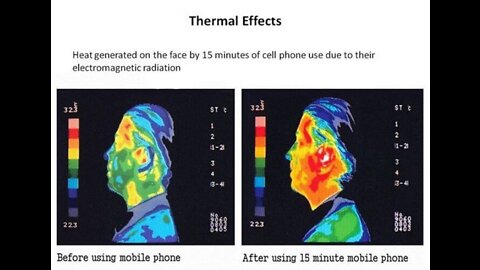 Can Cell Phone Radiation Damage Your Brain?