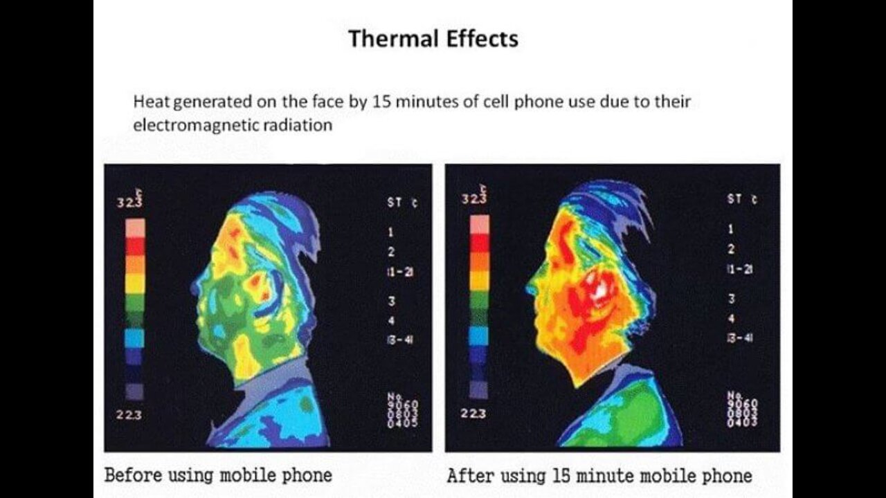 Can Cell Phone Radiation Damage Your Brain?