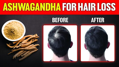 🌿 Can Ashwagandha Really Boost Your Hair Growth? 🌿 #Ashwagandha #HairGrowth #NaturalRemedies