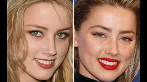 Amber Heard - Before & After - Plastic Surgery Transformation