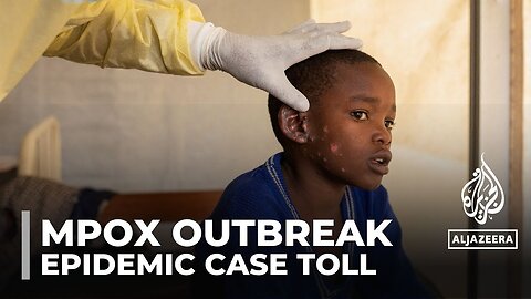 19,000 suspected or confirmed mpox cases this year