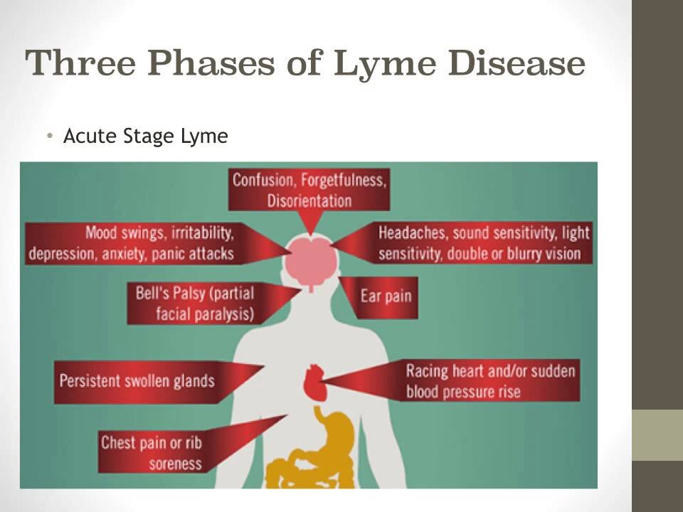 The Lyme Dilemma 2 | Dr. Kevin Conners - Conners Clinic