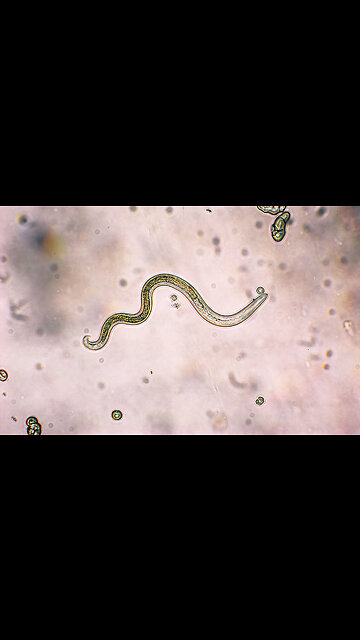 CANCER EVIDENCE REFLECTS PARASITES