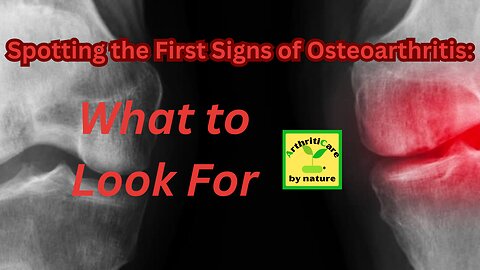 Spotting the First Signs of Osteoarthritis: What to Look For - ArthritiCare