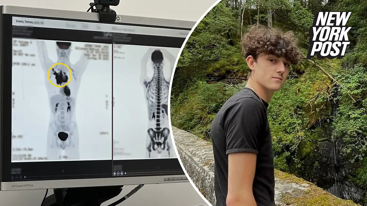 I thought I pulled a muscle lifting weights at the gym — it was cancer
