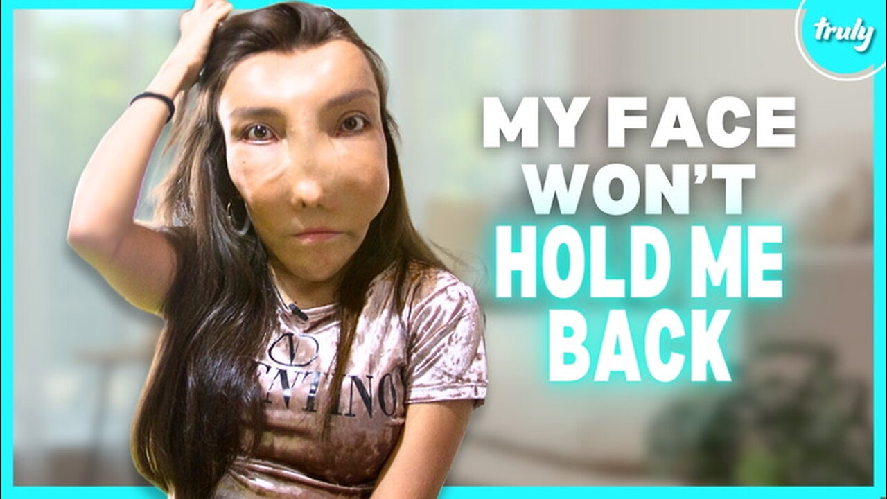 I’m Not Ashamed Of My Facial Deformity | BORN DIFFERENT