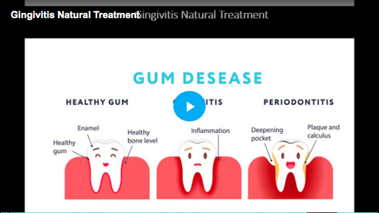 Learn about the natural treatment for gingivitis