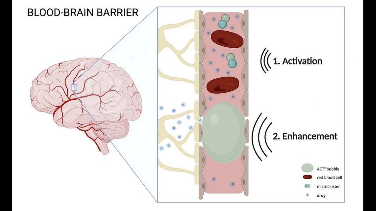 Wi-Fi and electromagnetic fields can open the blood-brain barrier