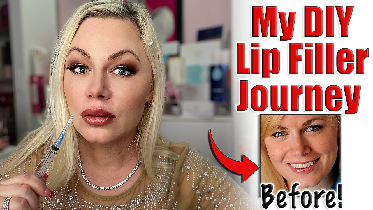 My DIY Lip Filler Journey! Before and After :) Code Jessica10 saves you Money at Approved Vendors