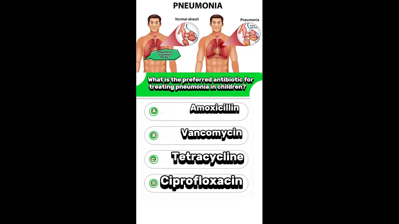 Pneumonia MCQs:Signs symptoms of Pneumonia #pneumonia #pharamacologyquiz #lungs