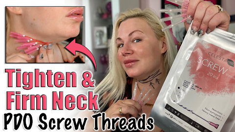 Tighten and Firm Neck with PDO Screw Threads from Celestapro.com | Code Jessica10 Saves you Money!