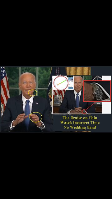 A bruise on the chin, a missing wedding band. And the watch with incorrect time.