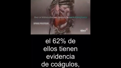 Continúan reportándose muchos efectos adversos de las “vacunas” COVID a nivel mundial.