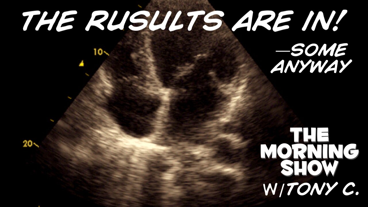 At Least There Is No Evidence of Aortic Valve Stenosis