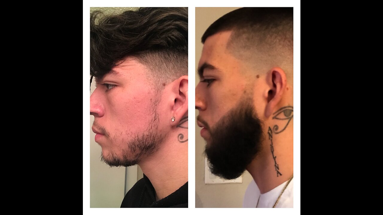 PART 2!!! SUCCESSFUL BEARD ROGAINE (MINOXIDIL) 8 MONTH EXPERIMENT