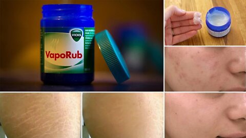 8 Surprising Uses of Vicks Vaporub