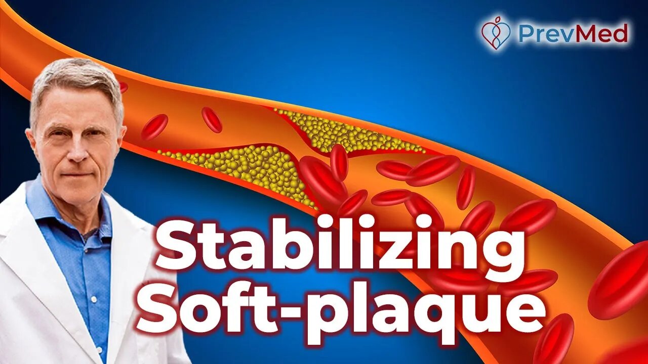 Stabilizing Soft-plaque