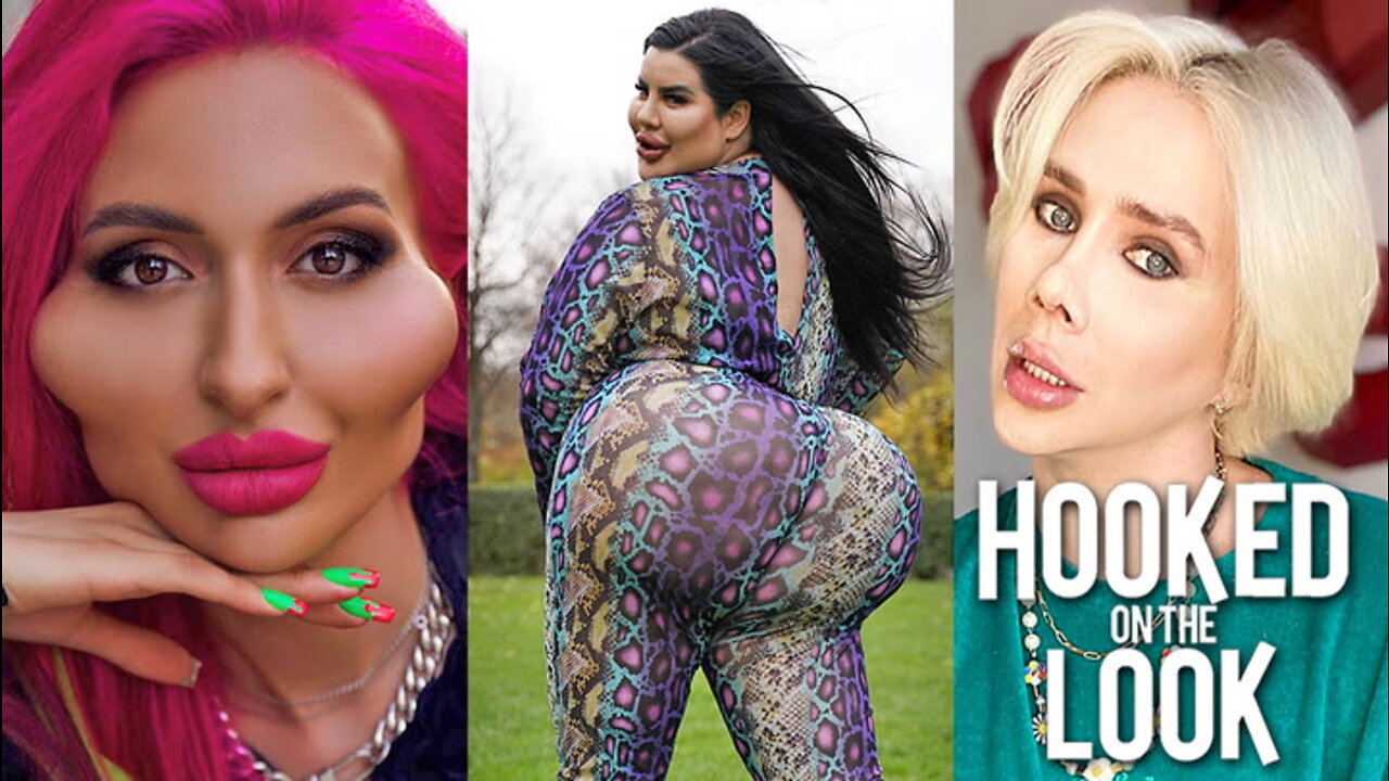 5 Plastic Surgeries That Stunned The World | HOOKED ON THE LOOK