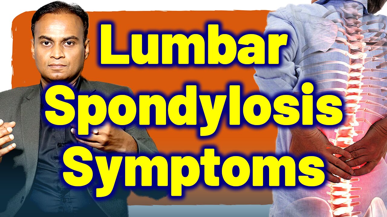 Signs and Symptoms of Lumbar Spondylosis - Homeopathy Treatment & Cure, Remedy | Dr. Bharadwaz