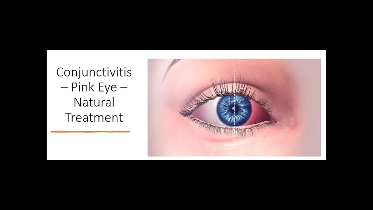 Conjunctivitis - Eye Infections Natural Treatment