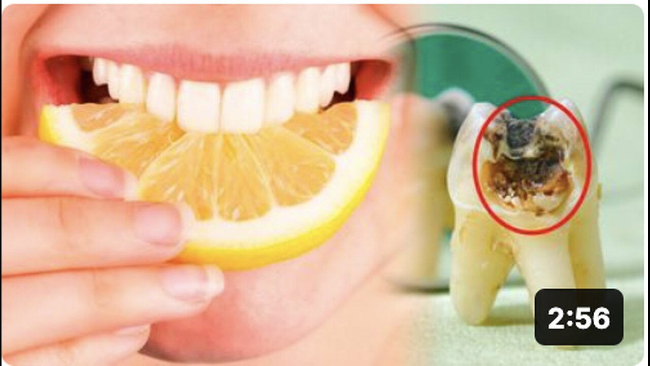 The 7 Worst Foods for Your Teeth