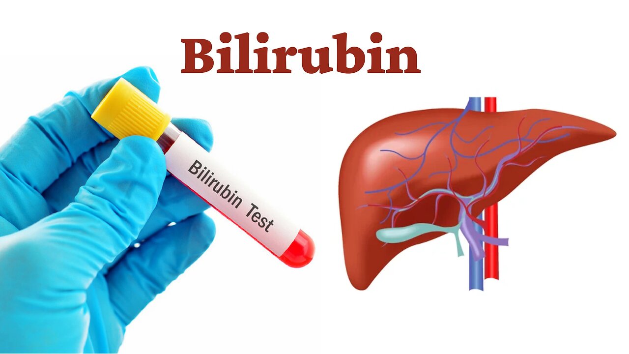 Bilirubin, types , normal range, from where produced and indicates
