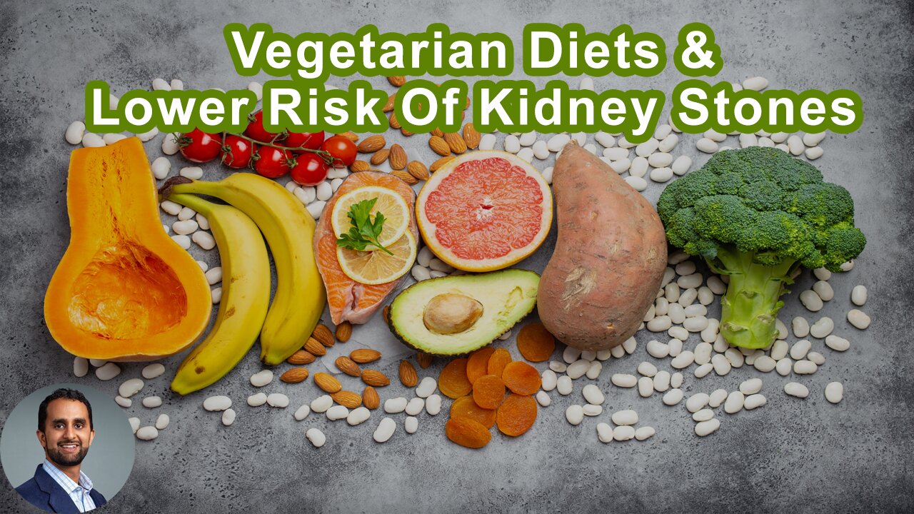 Those Eating A Vegetarian Diet Have Been Associated With A Lower Risk Of Kidney Stones